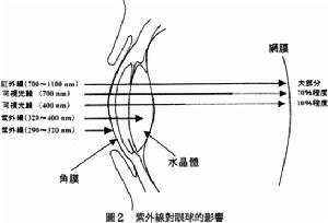 眼鏡要經(jīng)常戴嗎戴眼鏡眼睛會(huì)變形嗎?