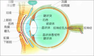 為什么會(huì)發(fā)展成高度近視？